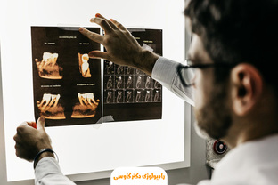 عکس CBCT دندان چیست: راهنمای جامع برای بیماران در اهواز