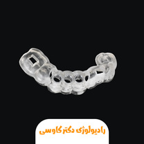 سرجیکال گاید چیست؟ کاربردها، مزایا و هر آنچه باید بدانید